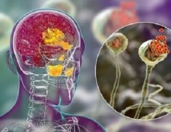 informaci�n importante sobre el hongo negro