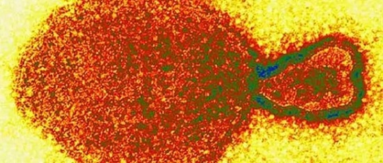 henipavirus, nuevo virus de origen animal detectado en china