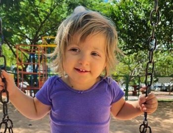 s�ntomas y tratamiento del s�ndrome rubinstein-taybi